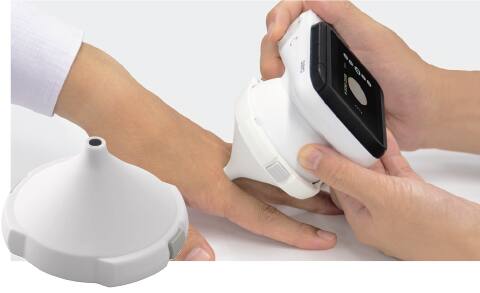 Nahaufnahme eines Adapter der dermatologischen Kamera, mit der zwischen den Fingern einer Person Aufnahmen gemacht werden können