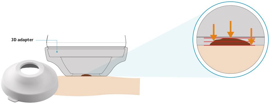Illustration des 3D-Adapters und seines Dermo AIF Modus