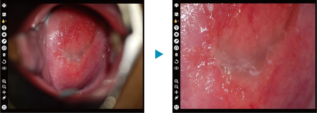 Two views of gynaecological images, scaled 1:1 and enlarged to the right.