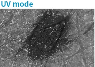 Prise de vue d'un grain de beauté avec la caméra dermatologique en « mode UV ».