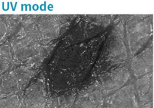 Prise de vue d'un grain de beauté avec la caméra dermatologique en « mode UV ».