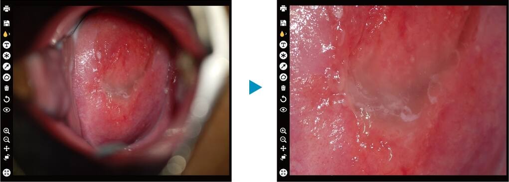 Duas vistas de imagens ginecológicas, em escala 1:1 e ampliadas à direita.