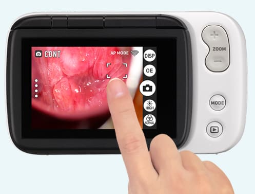 Visor da câmara ginecológica com focagem