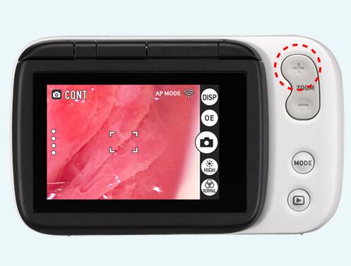 Visor da câmara ginecológica, a imagem pode ser ampliada com os botões