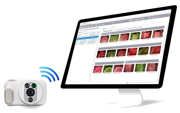 A câmara ginecológica CASIO ao lado de um ecrã no qual podem ser vistas as imagens da câmara