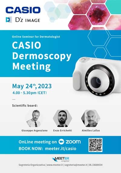 Previously recorded Casio Dermoscopy Meeting Casio Dermoscopy Meeting flyer