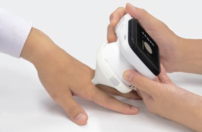 Een van de opzetstukken die op de dermatologische camera is bevestigd, wordt tussen twee vingers geplaatst