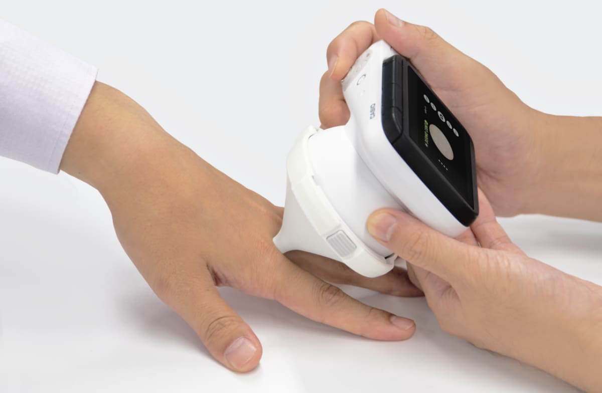 Een van de opzetstukken die op de dermatologische camera is bevestigd, wordt tussen twee vingers geplaatst