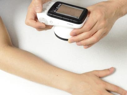 Een uitgestrekte arm, waarvoor een persoon de dermatologische camera DZ-D100 vasthoudt