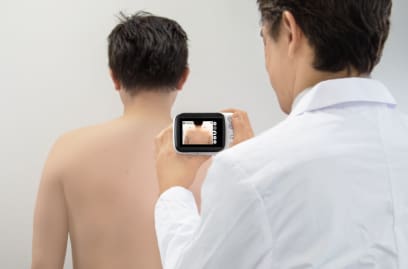 Een arts richt de dermatologische camera op de rug van een persoon die met ontbloot bovenlichaam voor een witte muur staat