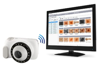 De dermatologische camera naast een computerscherm met beelden van de camera daarop.