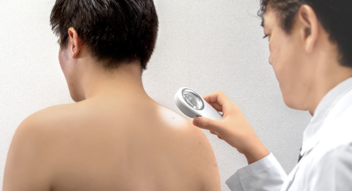 Een arts onderzoekt de rug van een patiënt met de dermatoscoop DZ-S50