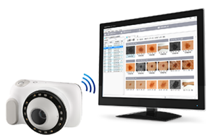 Dermatology DZ-D100: DERMOCAMERA Medical Device #5