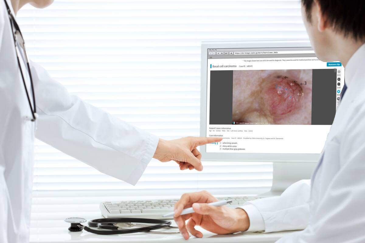 Dermatology DZ-D100: DERMOCAMERA Medical Device #6