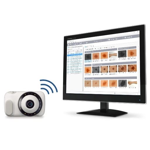 depiction DZ-D100 medical camera device communicating wirelessly to the D'z image viewer software
